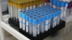 Проверяться на гепатит C нужно ежегодно — минздрав Ставрополья 