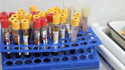 Кисловодчане могут сдать кровь или плазму 13 сентября