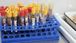 На Ставрополье показатель заболеваемости ВИЧ-инфекцией за год снизился на 4,6%