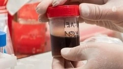 Донорская акция пройдёт в Кисловодске 1 марта